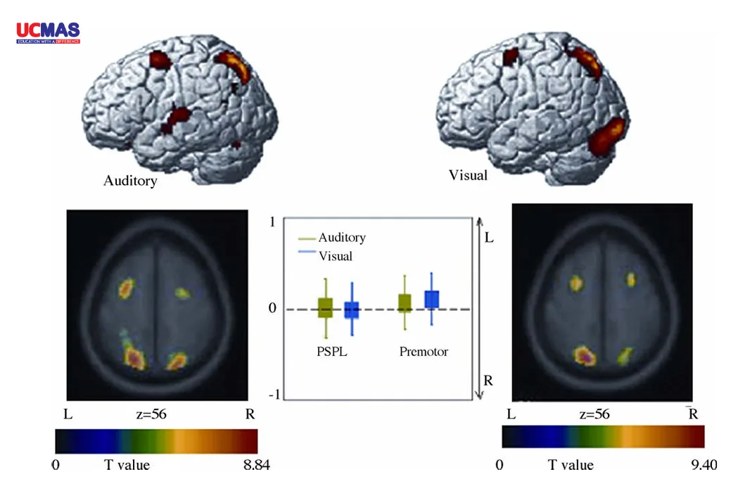 Hình 3. Hoạt động não fMRI dưới tác động của kích thích thị giác và thính giác trong bài CSA so với SSA.